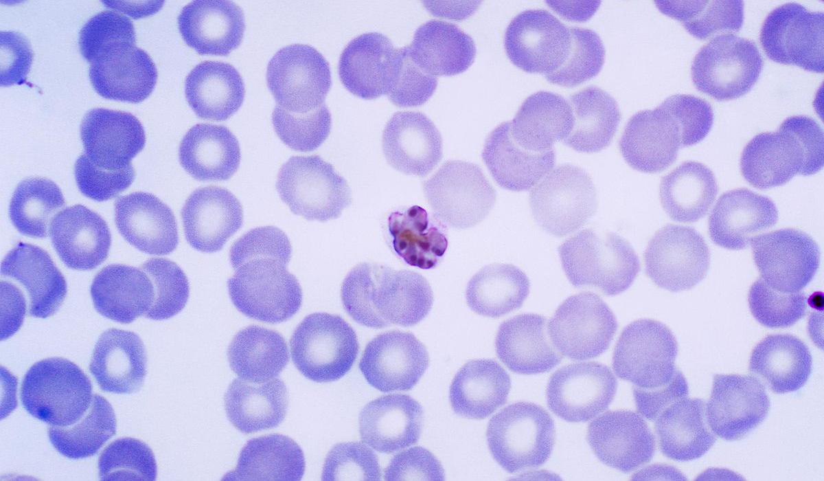 Plasmodium malariae